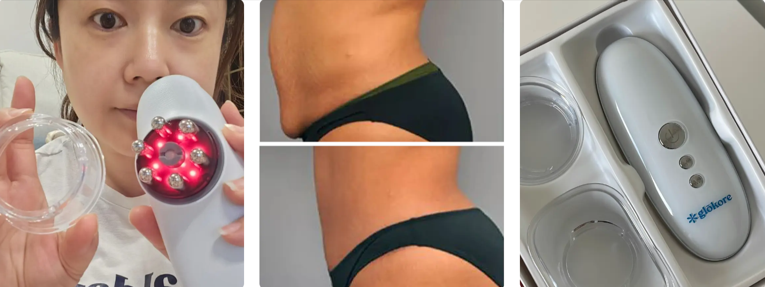 Glokore IPL Body Sculptor Customer Reviews